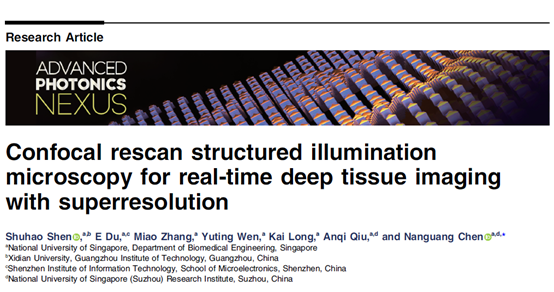 超分辨顯微成像迎來新突破,！新國大蘇研院陳南光團隊在《先進光子學(xué)通訊》發(fā)表科研成果